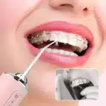 TOOTHCLEANSO11786__130625
